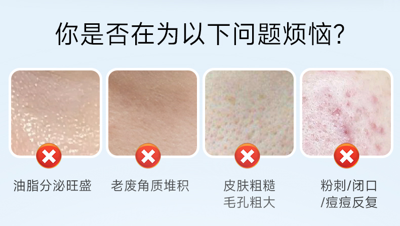 焕迹祛痘焕肤精华液
